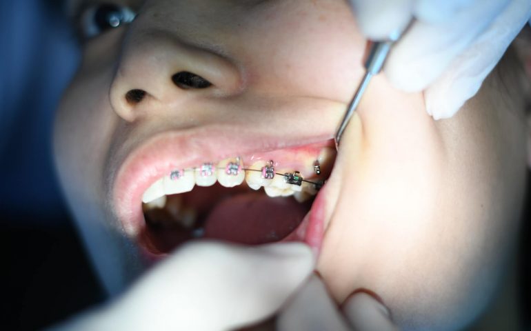 How Instagram Helps In Showcasing Your Dental Services